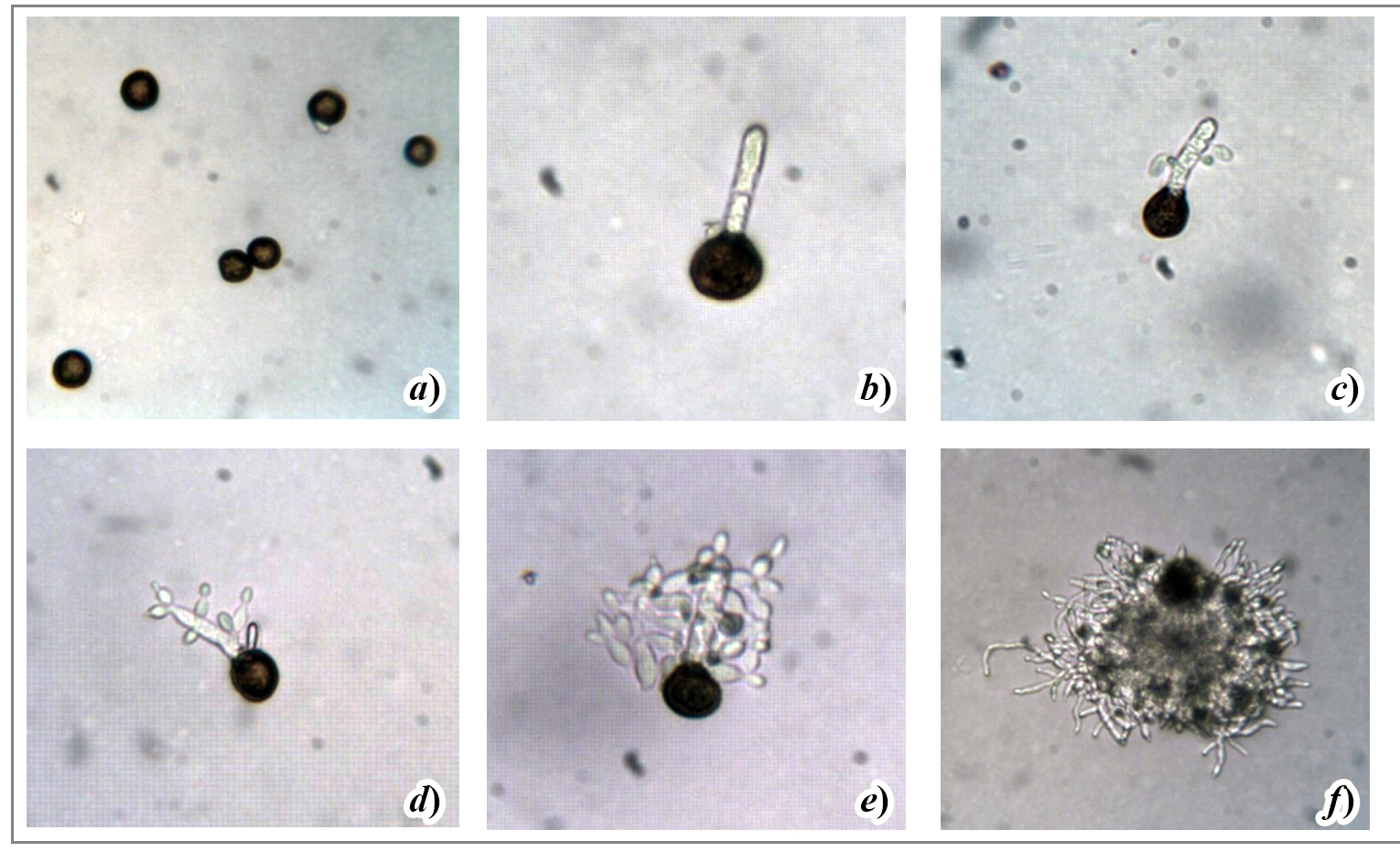 Proceso de germinación de una teliospora de Sporisorium reilianum f. sp. zeae (sinónimo Saphaceloteca reiliana)