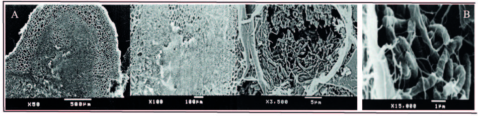 Microfotografías
de cortes histológicos del interior de los nódulos